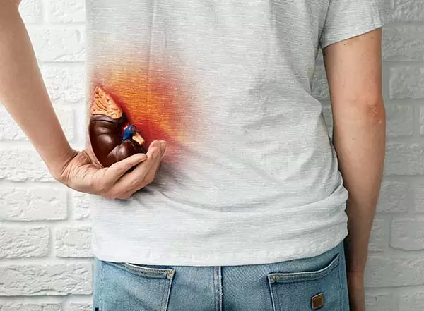 O que é a Doença Renal Crônica?